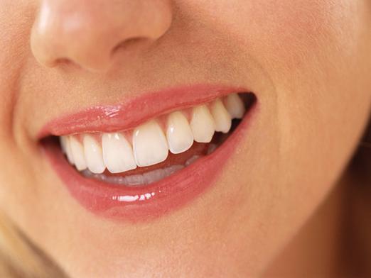 Come sbiancare i denti con il perossido?