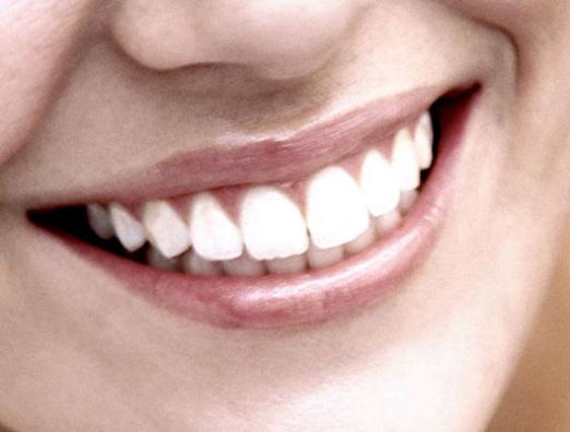 Come rafforzare i denti?